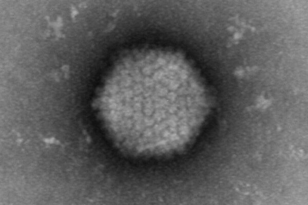 Grant supports research to develop gene therapy for cystic fibrosis